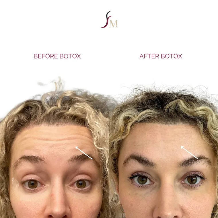 Facial Mania treatment result 5