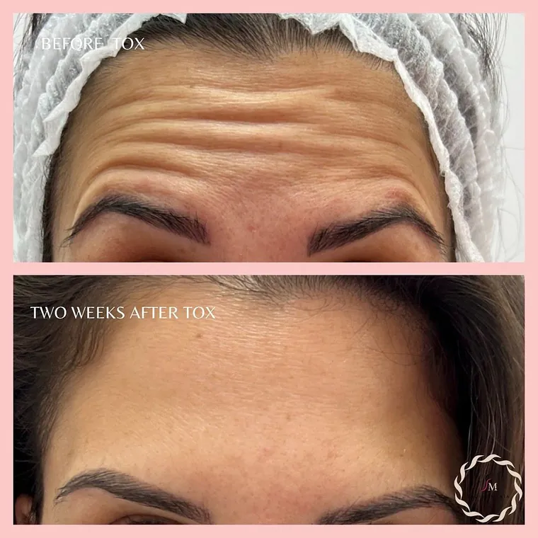 Facial Mania treatment result 6